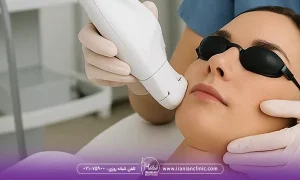 هزینه یک جلسه هایفوتراپی برای کل صورت