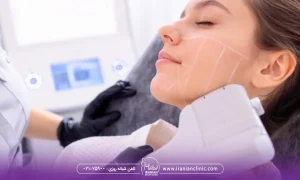 عوامل موثر در هزینه هایفوتراپی غبغب