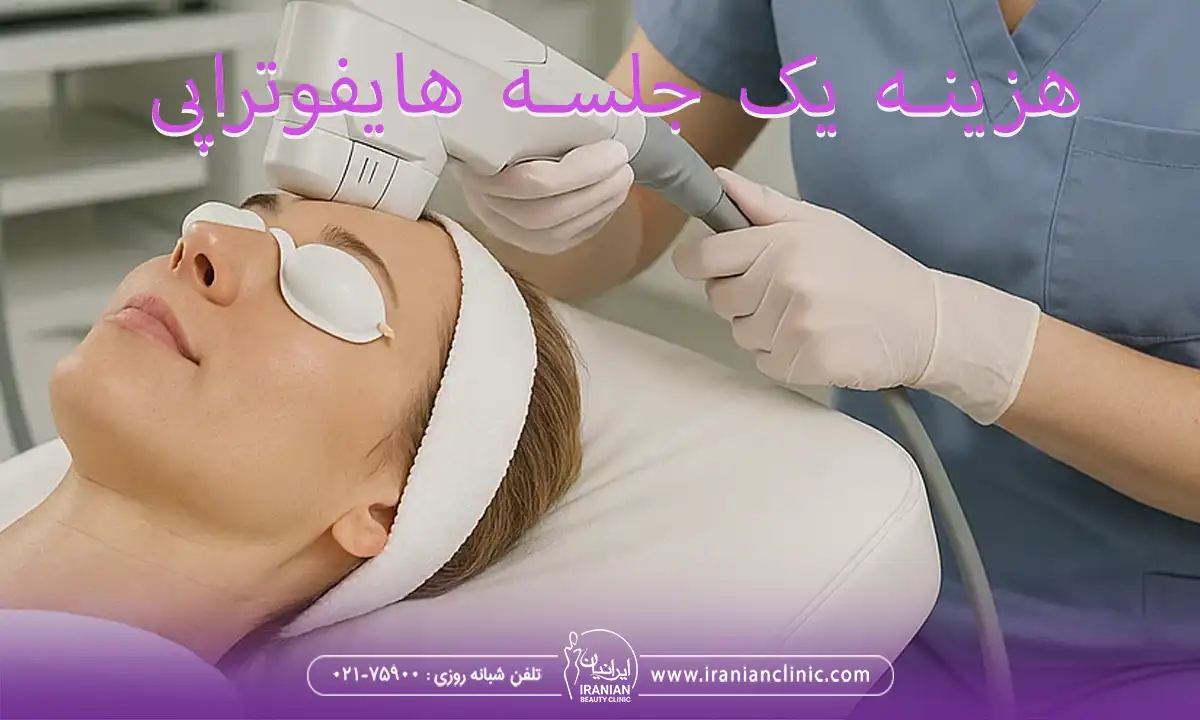 هزینه یک جلسه هایفوتراپی چقدر است