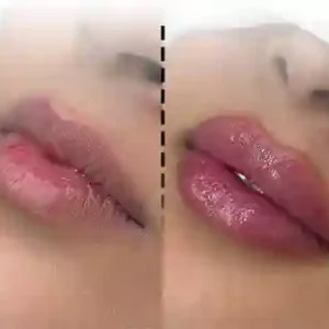 ژل لب روسی آلکاریسا با تخفیف ویژه ۲ میلیونی