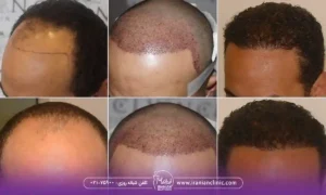  مراحل رشد مو بعد از کاشت و جدول مراحل رشد مو بعد از کاشت