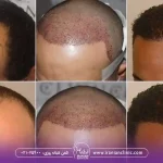  مراحل رشد مو بعد از کاشت و جدول مراحل رشد مو بعد از کاشت