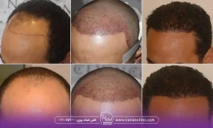  مراحل رشد مو بعد از کاشت و جدول مراحل رشد مو بعد از کاشت