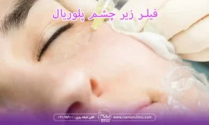 فیلر زیر چشم پلوریال و ژل زیر چشم پلوریال کلاسیک