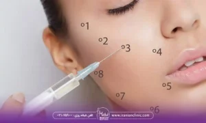 انواع فیلر پلوریال