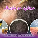 مزوتراپی مو پلوریال