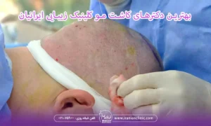 بهترین دکترهای کاشت مو کلینیک زیبایی ایرانیان در تهران