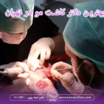 ویژگی های بهترین دکتر کاشت مو در تهران
