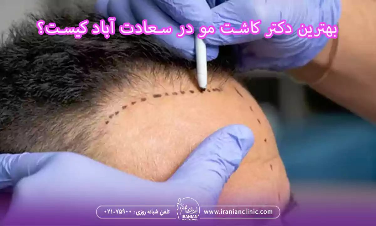 روش های مورد تایید بهترین دکتر کاشت مو در سعادت آباد تهران