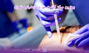  بهترین مرکز کاشت مو در زعفرانیه تهران