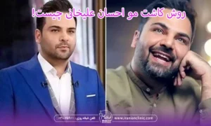 روش کاشت مو احسان علیخانی