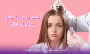 کاشت مو در 18 سالگی