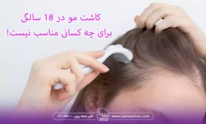 کاشت مو در 18 سالگی برای چه کسانی مناسب نیست!