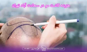 هزینه کاشت مو در سعادت آباد تهران و قیمت کاشت مو سعادت آباد تهران