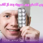  قرص برای کاهش ورم صورت بعد از کاشت مو