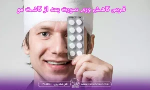 قرص برای کاهش ورم صورت بعد از کاشت مو