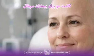 cancer-patients-hair-transplantation