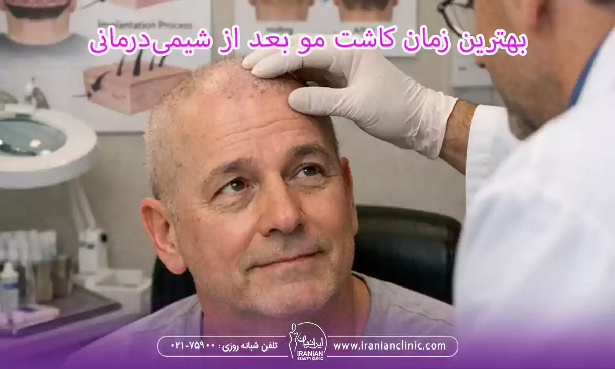 بهترین زمان کاشت مو بیماران سرطانی، کاشت مو بعد از شیمی درمانی از چه زمانی امکان پذیر است؟