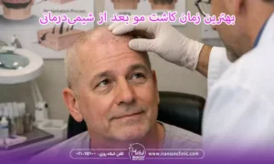 بهترین زمان کاشت مو بیماران سرطانی، کاشت مو بعد از شیمی درمانی از چه زمانی امکان پذیر است؟