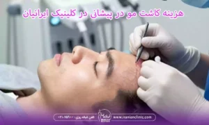 تفاوت قیمت کاشت مو در پیشانی در تهران و سایر مناطق