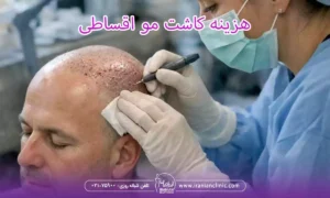 هزینه کاشت مو اقساطی و قیمت کاشت مو قسطی