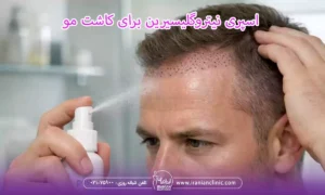 اسپری نیتروگلیسیرین برای کاشت مو