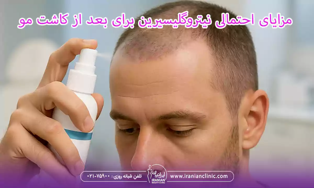 مزایای احتمالی نیتروگلیسیرین برای بعد از کاشت مو