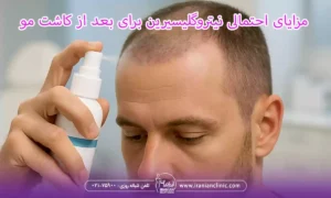 مزایای احتمالی نیتروگلیسیرین برای بعد از کاشت مو