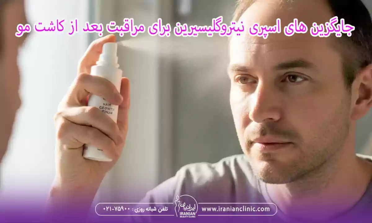 جایگزین های اسپری نیتروگلیسیرین برای مراقبت بعد از کاشت مو
