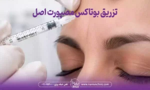 تزریق بوتاکس مصپورت اصلذ در ایرانیان، بوتاکس مصپورت آیا معتبر است؟