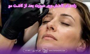 بهترین مرکز تزریق بوتاکس در غرب تهران