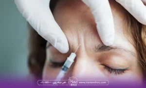 بهترین مرکز تزریق بوتاکس در غرب تهران