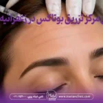 بهترین مرکز تزریق بوتاکس در زعفرانیه تهران