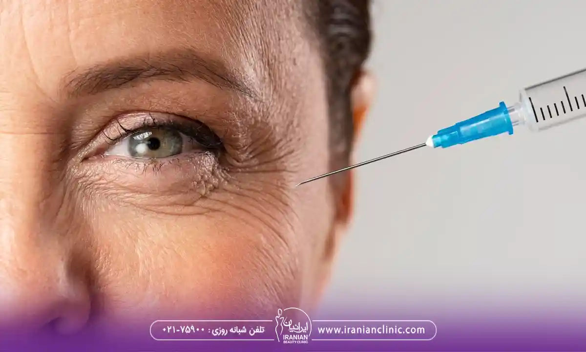 هزینه تزریق در مرکز تزریق بوتاکس در زعفرانیه ایرانیان