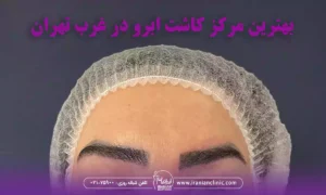 بهترین مرکز کاشت ابرو در غرب تهران