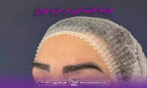 هزینه کاشت بهترین مرکز کاشت ابرو در غرب تهران