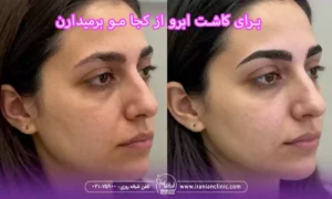 برای کاشت ابرو از کجا مو برمیدارن