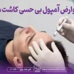 عوارض آمپول بی حسی کاشت مو عوارض نادر و شایع که باید بدانید
