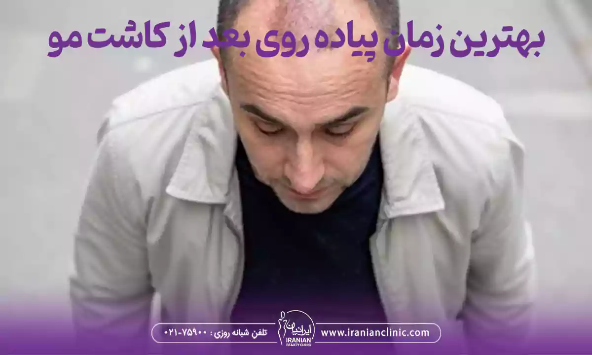 پیاده روی بعد از کاشت مو از چه زمانی مجاز است؟