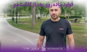 فواید پیاده روی بعد از کاشت مو و نکات مهم که باید بدانید!