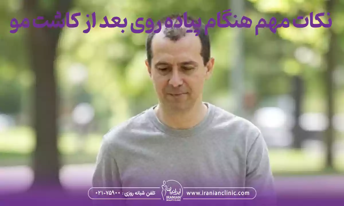 چه نکاتی را هنگام پیاده روی بعد از کاشت مو باید رعایت کنید؟
