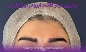 بهترین مرکز کاشت ابرو در تهرانپارس