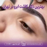 بهترین دکتر کاشت ابرو در تهران