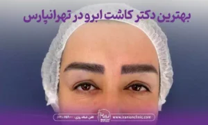 بهترین دکتر کاشت ابرو در تهرانپارس تهران