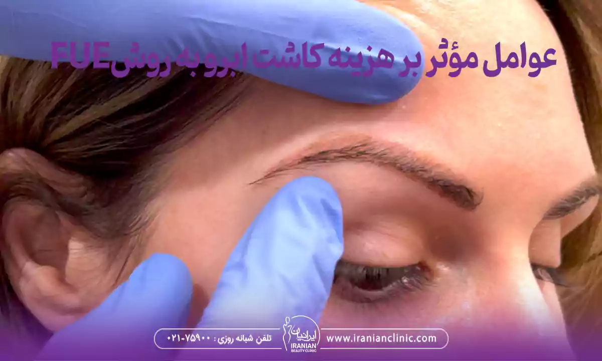 عوامل مؤثر بر هزینه کاشت ابرو به روش FUE