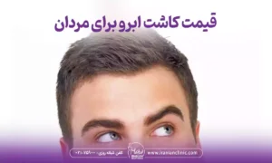 قیمت کاشت ابرو برای مردان و هزینه کاشت ابرو مردانه
