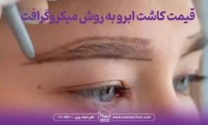 قیمت کاشت ابرو به روش میکروگرافت و هزینه کاشت ابرو میکروگرافت