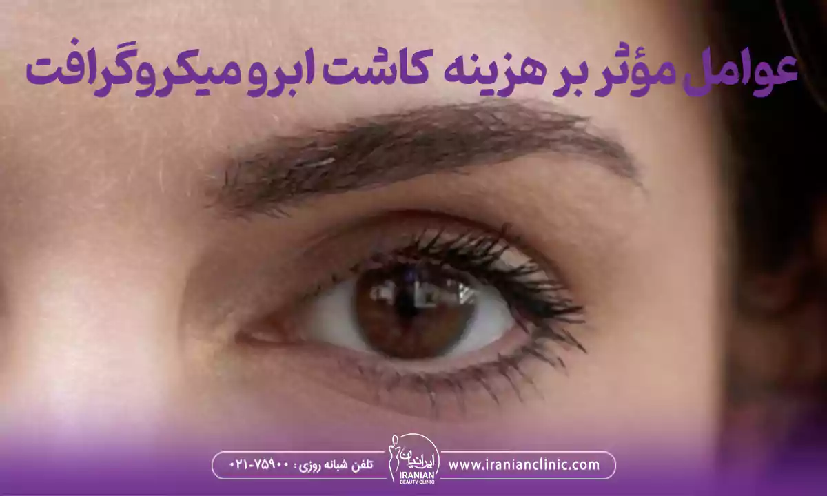 عوامل مؤثر بر هزینه کاشت ابرو به روش میکروگرافت