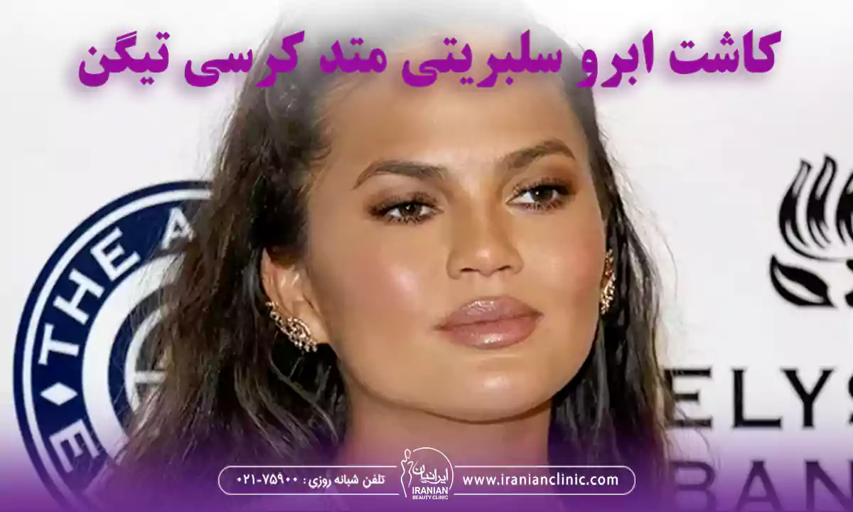 کاشت ابرو سلبریتی متد کرسی تیگن
