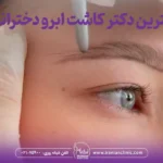 بهترین دکتر کاشت ابرو دخترانه